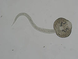 250px-Fascioloides_magna_cercariae.jpg